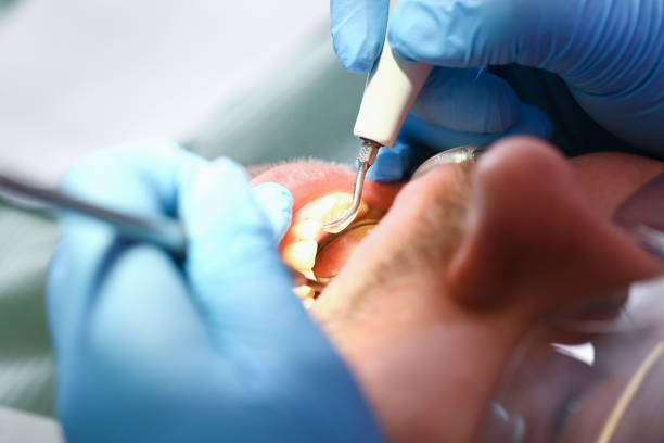 Best Emergency Broken Tooth Repair in Meadowbrook, AL
