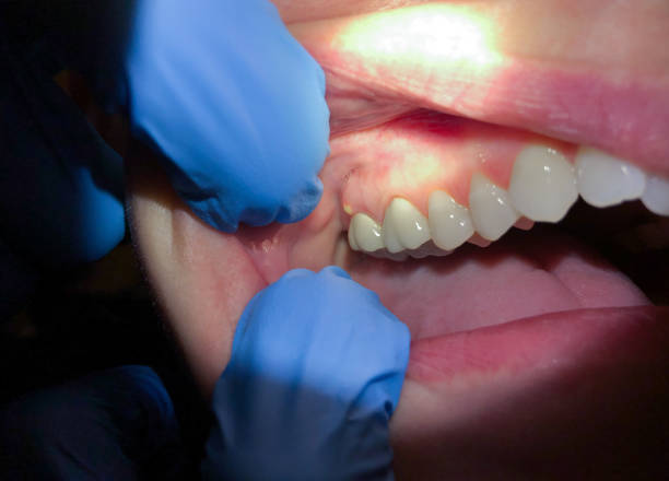 Best Pediatric Emergency Dentist in Meadowbrook, AL